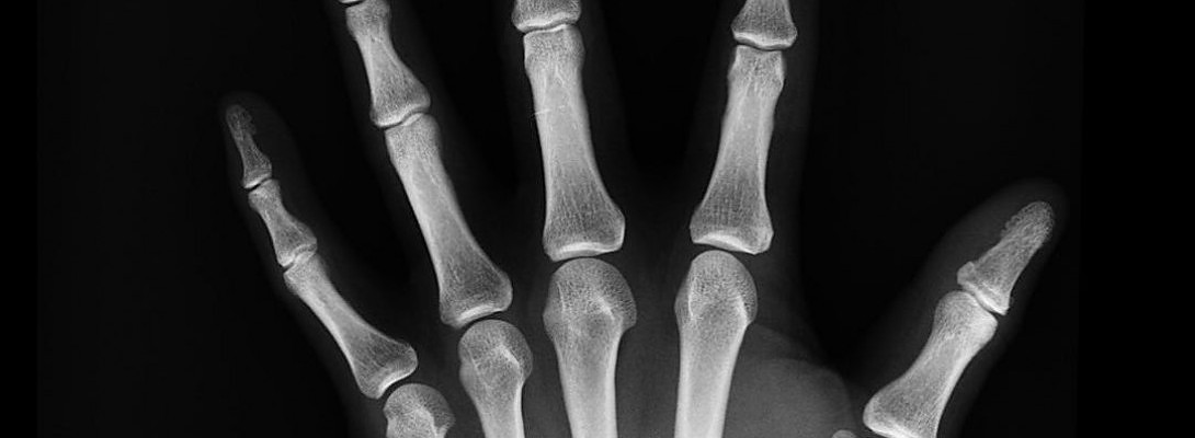 My journey to good health. Subject- Osteoporosis, Arteriosclerosis & More!