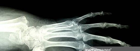 Not Typing 30 Plus Words A Minute.Yet