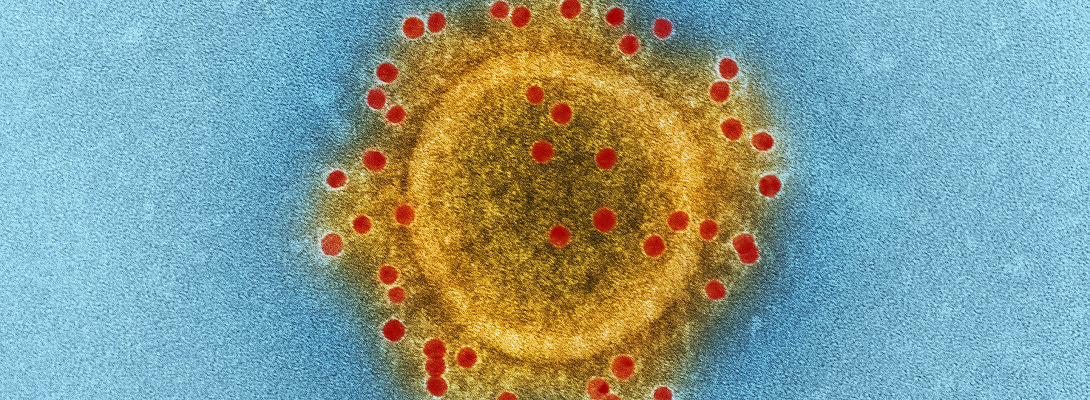 Covid-19 is behind the door!