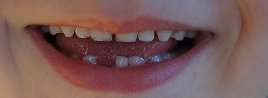 So thankful for being at this place at this time in my life, her first tooth gap!