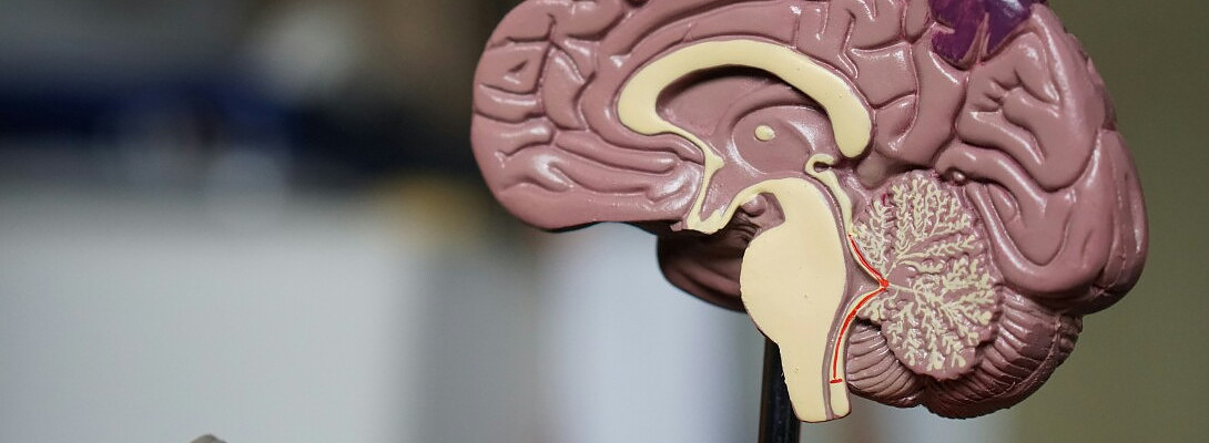 Cutting Back on Wealth Affiliate Activities