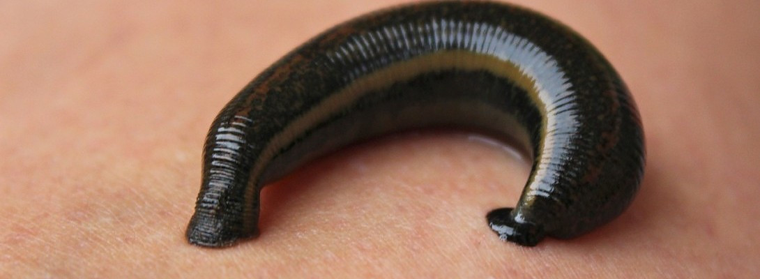 How 54 Leeches Saved my Finger and the Lessons I've Learned